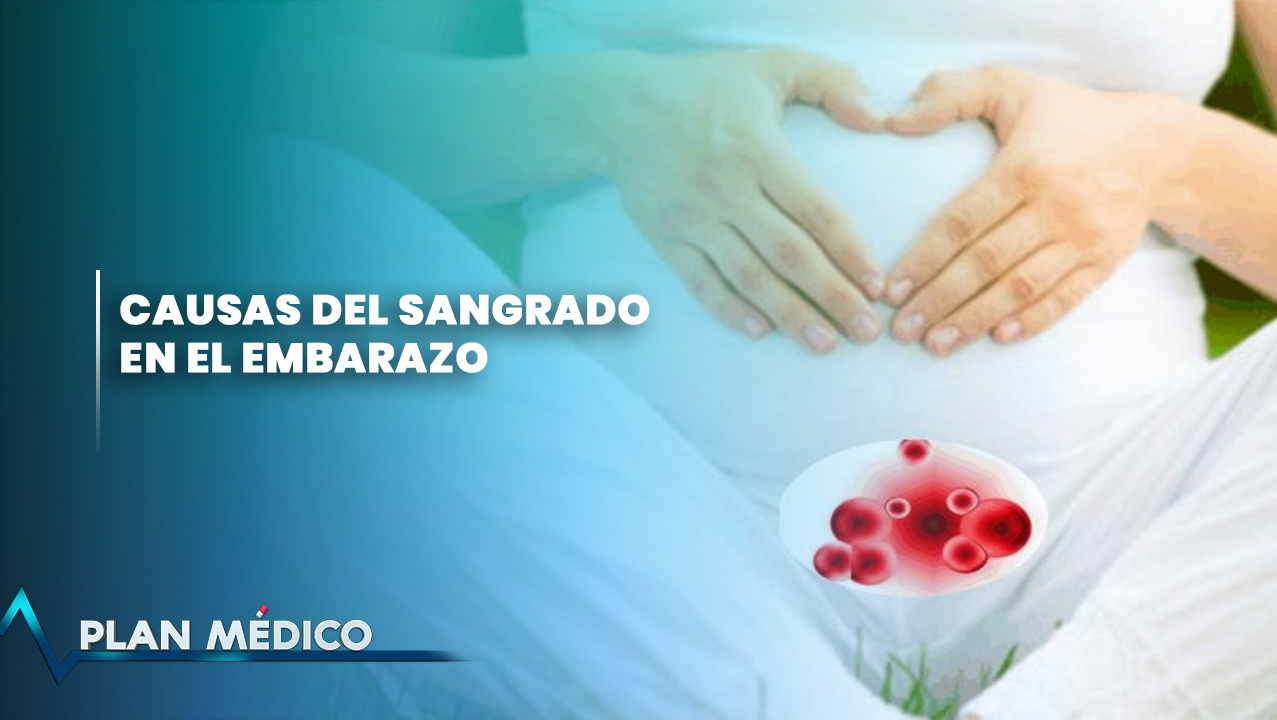 Causas Del Sangrado En El Embarazo Plan Médico 0981