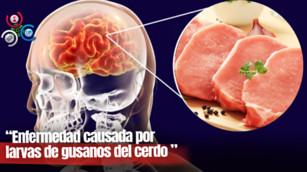 Consumo De Cerdo Podría Relacionarse Con Una Infección Parasitaria En El Cerebro