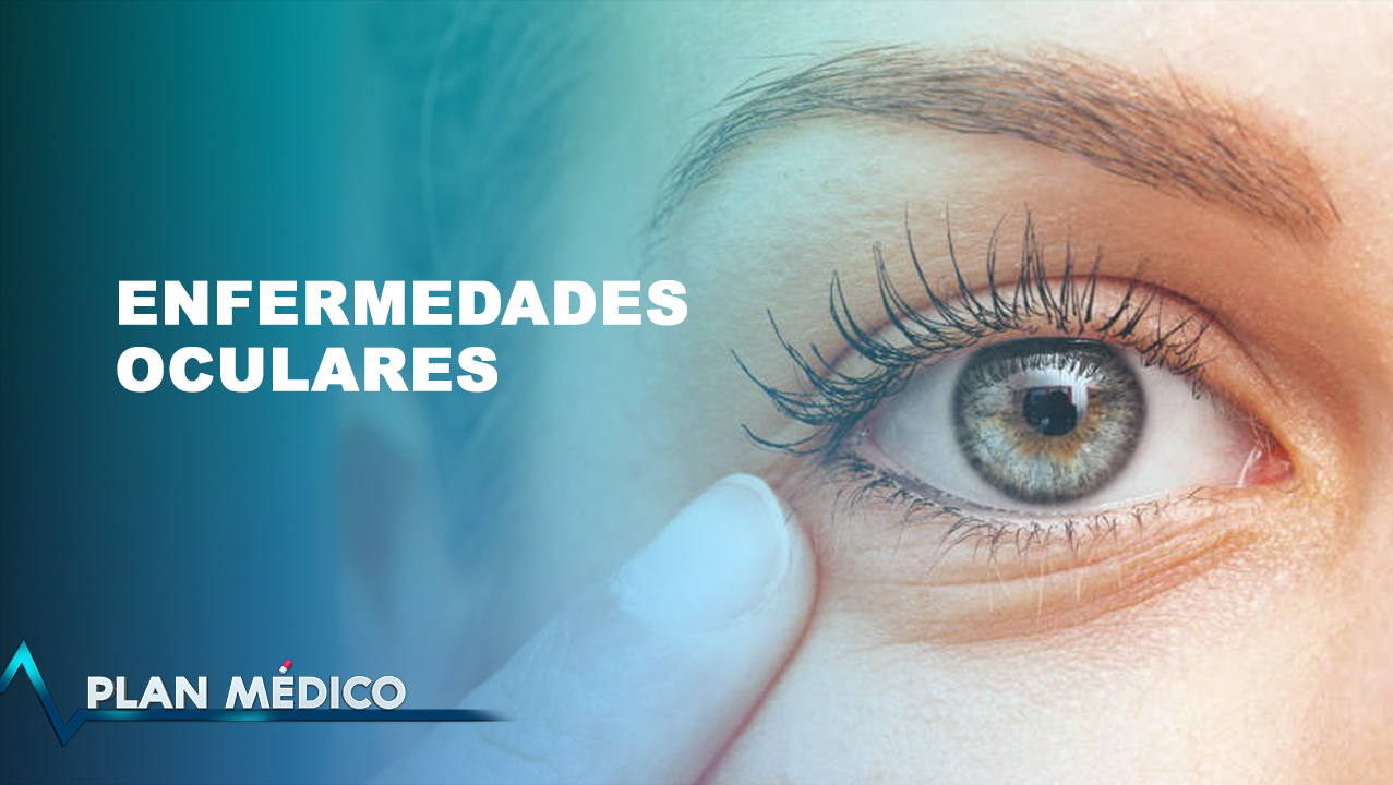 Las Enfermedades Oculares Más Comunes Plan Médico 6242