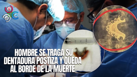 Hombre De 81 Años Vive Tras Durar Cuatro Días Con Dentadura Postiza Atrapada En La Garganta